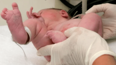 Ajab-Gajab : दो प्राइवेट पार्ट और एक अंडकोष के साथ इस बच्चे का हुआ जन्म, डॉक्टर भी हैरान, बताई चौकाने वाली वजह…