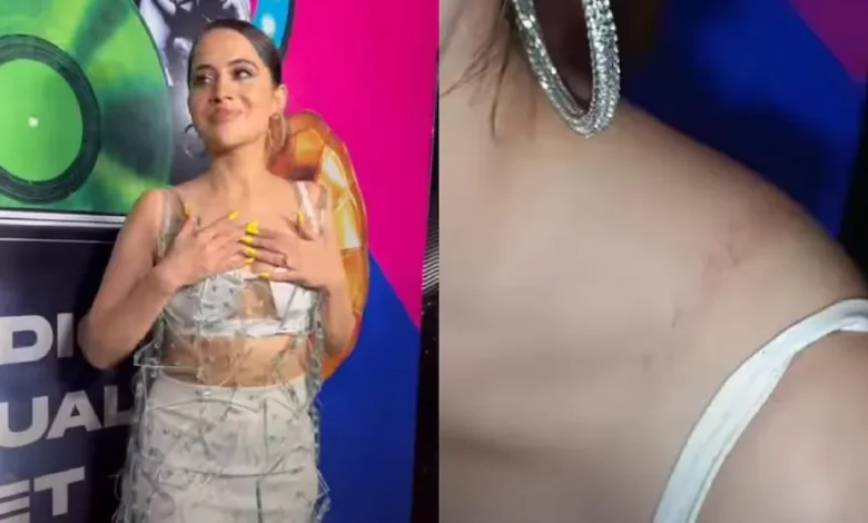 Urfi javed: कांच से बना ड्रेस पहनना उर्फी को पड़ा भारी, चुभा ऐसी जगह की निकल आये आंसू…